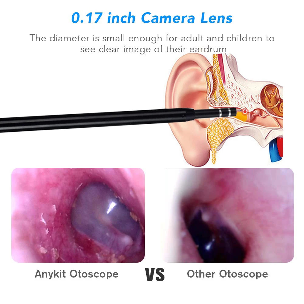 3-in-1 HD Ear Cleaning Endoscope Camera - Visual Ear Cleaner with 720P HD, Adjustable LED, Compatible with Android, Windows & MAC