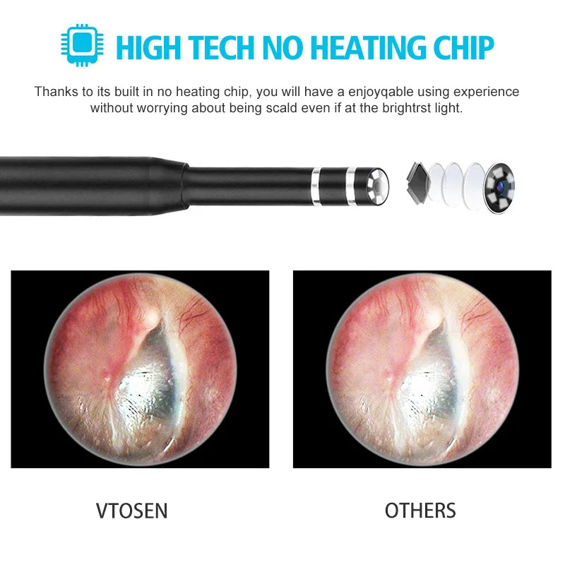 3-in-1 HD Ear Cleaning Endoscope Camera - Visual Ear Cleaner with 720P HD, Adjustable LED, Compatible with Android, Windows & MAC